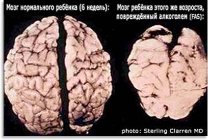 Алкоголь — оружие геноцида