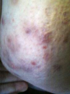 Дженнифер Рексфорд сделала 3 января 2011 года