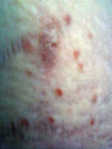 Дженнифер Рексфорд сделала 3 января 2011 года