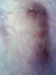 Дженнифер Рексфорд сделала 3 января 2011 года