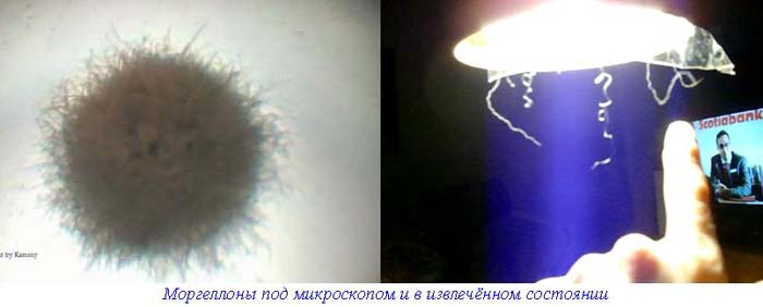 моргеллоны