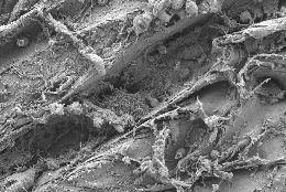 image075.jpg бактерия, поедающая пластик