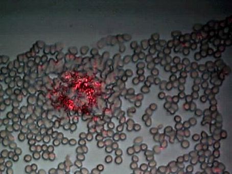 image069.jpg биокомпоненты из химтрейла среди клеток крови