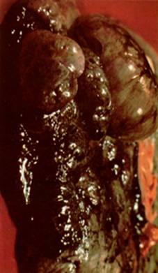 Такие или почти такие лёгкие у всех курильщиков.